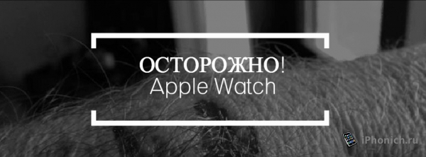Осторожно! <a href="https://iphonich.ru/24553-luchshie-apple-watch.html">Apple Watch</a> калечит людей.